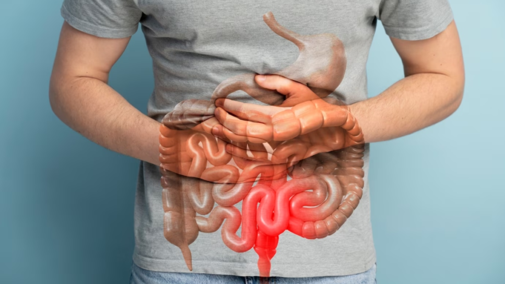 Gut Health