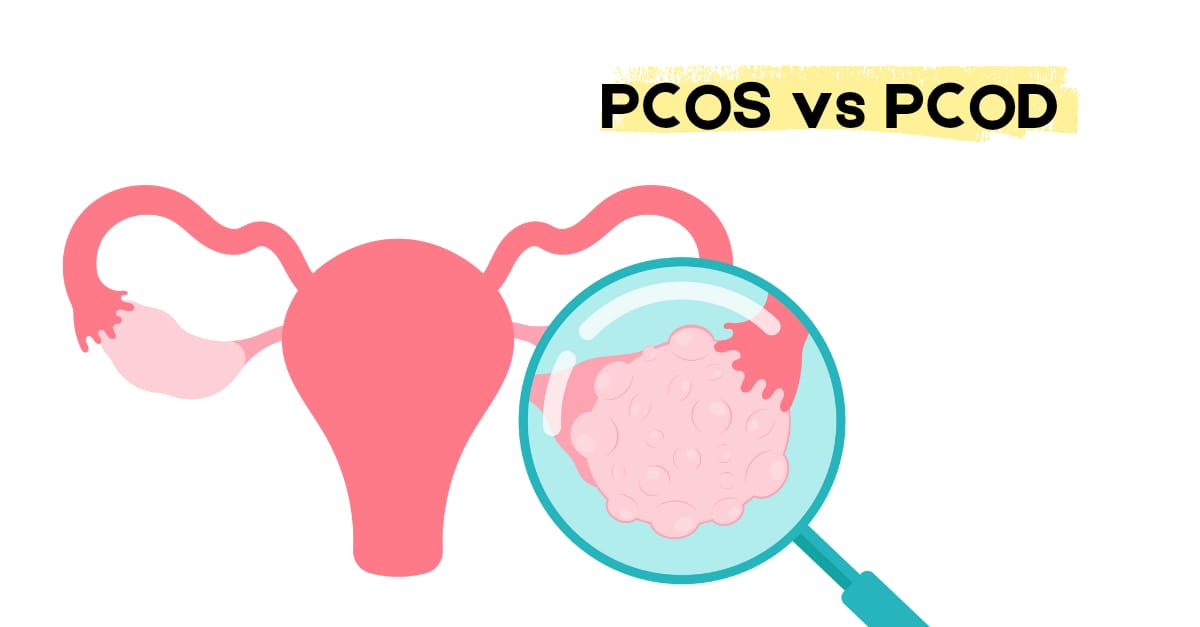 PCOD-PCOS-Difference: