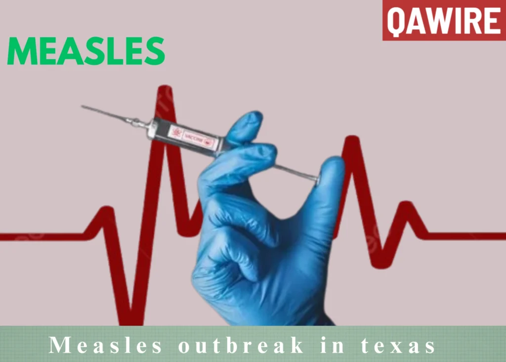 Texas measles outbreak